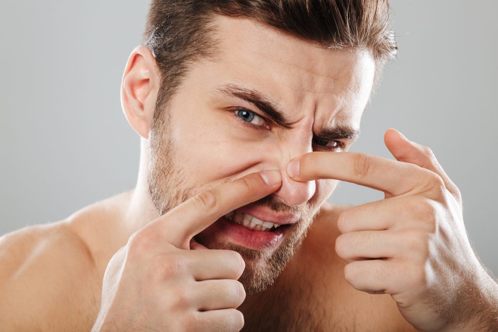 cicatrices-y-marcas-post-acne-con-anesi-t3-2